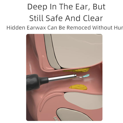 Ear Cleaner with WiFi Camera