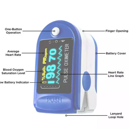 Pulse oximeter with labeled parts on a white background
