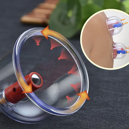 Transparent cupping device with red and yellow components on a dark surface, with an inset showing a close-up of the device's mechanism.