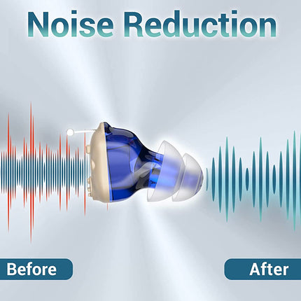 Hearing aid with sound wave graphics labeled 'Before' and 'After' on a light gray background.