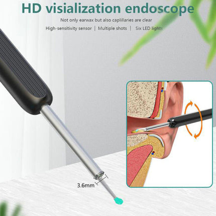HD visualization endoscope with close-up of ear inspection on a light gray background