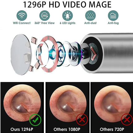 Ear examination tool with camera lens and comparison of video quality on a white background