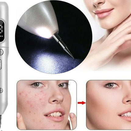 Skin Tag Remover Pen | NZ Sale