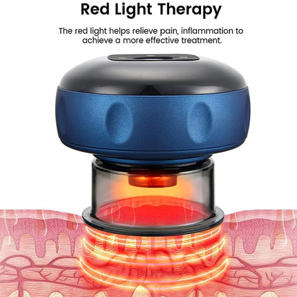 Cupping Set Electric Massager | NZ Sale
