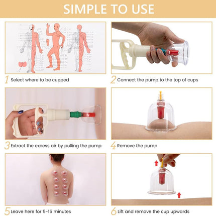 Instructions for using a cupping device with step-by-step illustrations.