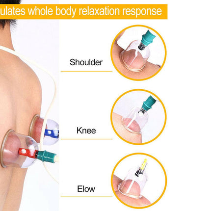 Cupping therapy application on shoulder, knee, and elbow with text indicating relaxation response.