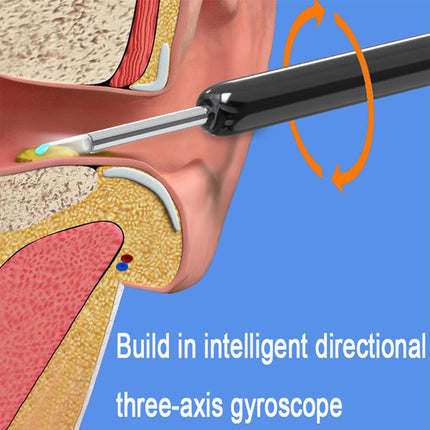 Diagram of a medical device being inserted into a body cavity with text about an intelligent directional three-axis gyroscope.
