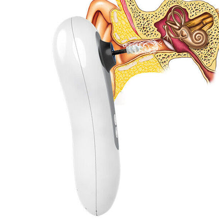 White earbud with a detailed anatomical illustration of an ear behind it on a white background